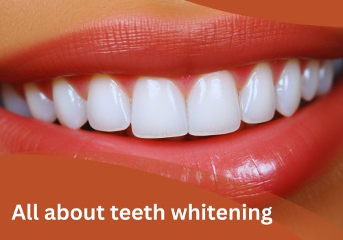A close-up of a smiling mouth with white teeth and pink lips, with the text "All about Teeth Whitening" overlaid on a brownish-orange background.